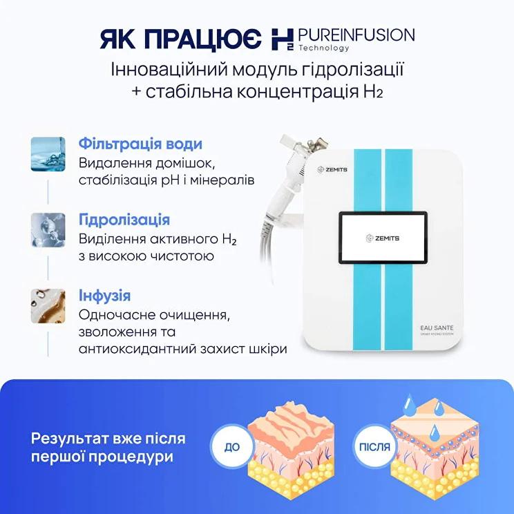 Zemits Eau Sante NG Апарат гідродермабразії та водневого пілінгу