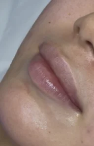До