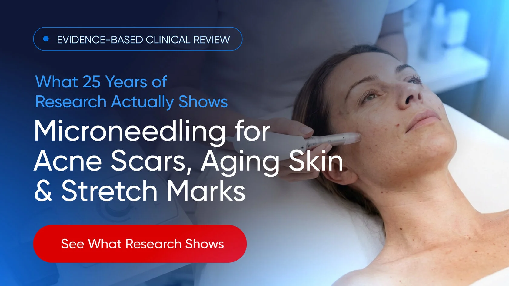 XCellaris PRO Twist FDA-cleared Class II Microneedling System