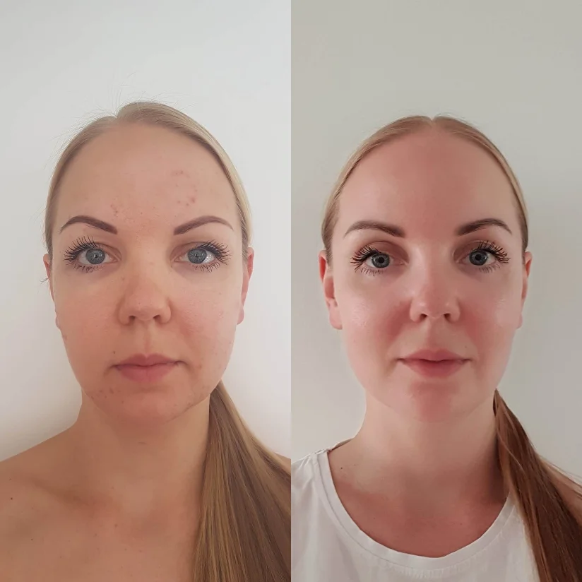 Look 5 10 years younger after taking my Face Fitness courses