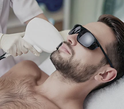 Laser Hair Removal for Men